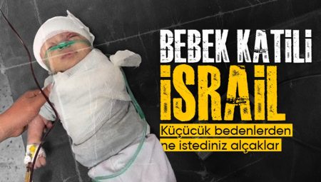 İsrail akınlarında kolu kopan Gazzeli minik bebek